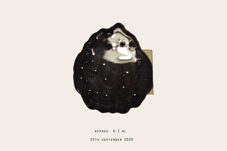 17 Weeks and 5 Days — 17